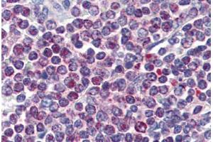 Immunohistochemistry (Paraffin-embedded Sections) (IHC (p)) image for anti-Nuclear Factor of Activated T-Cells, Cytoplasmic, Calcineurin-Dependent 1 (NFATC1) (AA 428-716) antibody (ABIN364442)