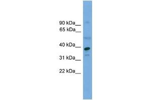 WB Suggested Anti-APEX1  Antibody Titration: 0. (APEX1 antibody  (Middle Region))