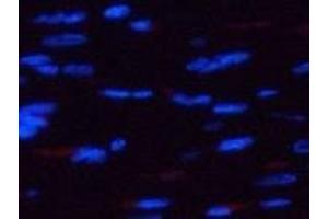 Immunofluorescence analysis of Rat heart tissue using Phospho-AMPK alpha1/2 (Thr183/172) Polyclonal Antibody at dilution of 1:200 (PRKAA1/PRKAA2 antibody  (pThr172, pThr183))