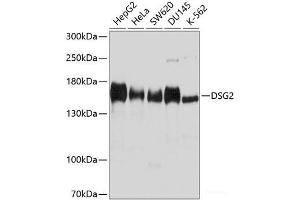 Western blot analysis of extracts of various cell lines using DSG2 Polyclonal Antibody at dilution of 1:1000. (Desmoglein 2 antibody)
