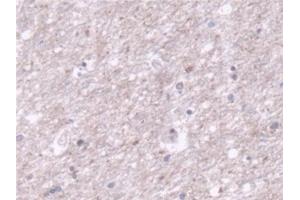Detection of TOMM70A in Human Cerebrum Tissue using Polyclonal Antibody to Translocase Of Outer Mitochondrial Membrane 70A (TOMM70A) (TOM70 antibody  (AA 333-608))