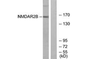 Western blot analysis of extracts from Jurkat cells, using NMDAR2B (Ab-1474) Antibody. (GRIN2B antibody  (AA 1435-1484))