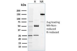 SDS-PAGE Analysis Purified NRF1 Mouse Monoclonal Antibody (NRF1/2608). (NFE2L1 antibody)