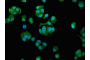 Immunofluorescence staining of MCF-7 cells with ABIN7171423 at 1:100, counter-stained with DAPI. (CCT7 antibody  (AA 240-543))