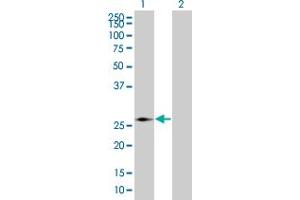 Western Blot analysis of PMM2 expression in transfected 293T cell line by PMM2 MaxPab polyclonal antibody. (PMM2 antibody  (AA 1-246))