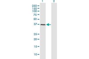 Western Blot analysis of RNF2 expression in transfected 293T cell line by RNF2 monoclonal antibody (M03), clone 3G6. (RNF2 antibody  (AA 192-290))