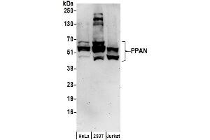 anti-Peter Pan Homolog (PPAN) (AA 375-425) antibody