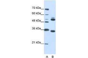 WB Suggested Anti-WDR6  Antibody Titration: 0. (WDR6 antibody  (C-Term))