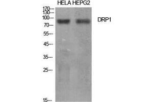 Western Blot (WB) analysis of specific cells using DRP1 Polyclonal Antibody. (Dynamin 1-Like antibody  (Tyr516))
