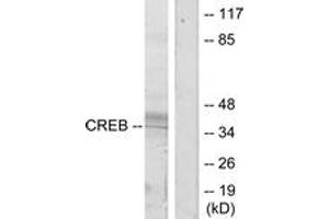 Western blot analysis of extracts from HeLa cells, treated with UV, using CREB (Ab-133) Antibody. (CREB1 antibody  (AA 100-149))