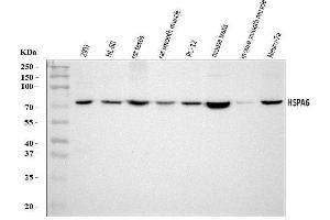 Western blot analysis of HSPA6 using anti-HSPA6 antibody (ABIN7601944).