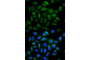 Immunofluorescence analysis of HeLa cells using AFP antibody. (alpha Fetoprotein antibody  (AA 360-609))