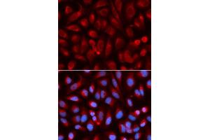 Immunofluorescence analysis of U2OS cell using ADA antibody. (ADA antibody  (AA 1-363))