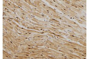 ABIN6269012 at 1/100 staining Rat heart tissue by IHC-P. (HSP70 1A antibody  (C-Term))
