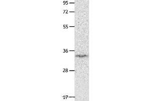 Western blot analysis of Mouse brain tissue, using IGFBP7 Polyclonal Antibody at dilution of 1:400 (IGFBP7 antibody)