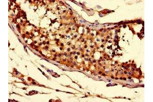 Immunohistochemistry of paraffin-embedded human testis tissue using ABIN7170279 at dilution of 1:100 (Solute Carrier Family 52 (Riboflavin Transporter), Member 3 (SLC52A3) (AA 159-220) antibody)