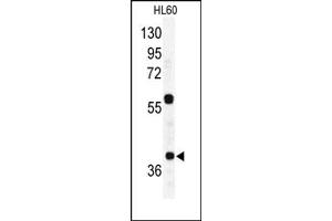 Image no. 2 for anti-RAD23 Homolog A (RAD23A) (C-Term) antibody (ABIN357606) (RAD23A antibody  (C-Term))