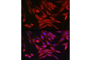 Immunofluorescence analysis of NIH/3T3 cells using MRPL28 Rabbit mAb (ABIN7268566) at dilution of 1:100 (40x lens). (MRPL28 antibody)