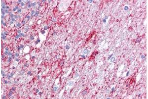 Anti-ATG9A antibody IHC staining of human brain, cerebellum.