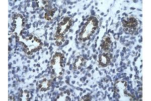 Rabbit Anti-USE1 Antibody       Paraffin Embedded Tissue:  Human alveolar cell   Cellular Data:  Epithelial cells of renal tubule  Antibody Concentration:   4. (UBE2Z antibody  (Middle Region))