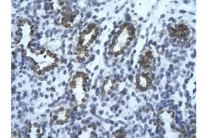 Rabbit Anti-USE1 Antibody       Paraffin Embedded Tissue:  Human alveolar cell   Cellular Data:  Epithelial cells of renal tubule  Antibody Concentration:   4. (UBE2Z antibody  (Middle Region))