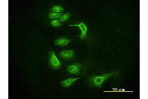 Immunofluorescence of monoclonal antibody to EIF2C2 on HeLa cell. (AGO2 antibody  (AA 1-377))
