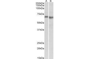 AP21300PU-N AMPK2 antibody staining of Mouse (A) and Rat (B) Heart lysate at 0. (PRKAA2 antibody  (Internal Region))