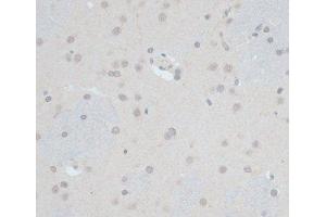 Immunohistochemistry of paraffin-embedded Rat brain using ZNF703 Polyclonal Antibody at dilution of 1:100 (40x lens). (ZNF703 antibody)
