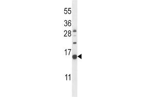 Western Blotting (WB) image for anti-Natriuretic Peptide Type C (NPPC) antibody (ABIN2997683)