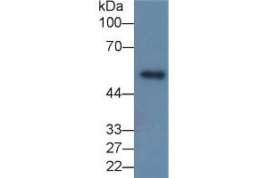 Detection of MMP8 in Porcine Skin lysate using Monoclonal Antibody to Matrix Metalloproteinase 8 (MMP8) (MMP8 antibody  (AA 101-467))