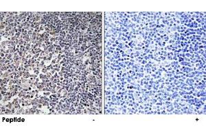 Immunohistochemistry analysis of paraffin-embedded human tonsil tissue using MRPS16 polyclonal antibody .