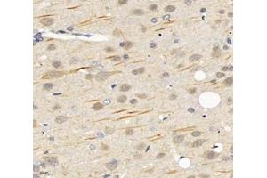 Immunohistochemistry analysis of paraffin-embedded rat brain using,SCN8A (ABIN7075647) at dilution of 1: 1200 (SCN8A antibody)