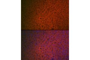 Immunofluorescence analysis of rat liver cells using Factor IX / F9 Rabbit pAb (ABIN3022173, ABIN3022174, ABIN3022175, ABIN1512886 and ABIN6218646) at dilution of 1:100 (40x lens). (Coagulation Factor IX antibody  (AA 29-192))