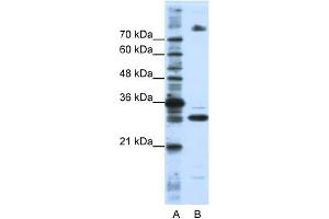 WB Suggested Anti-FUSIP1  Antibody Titration: 0. (SRSF10 antibody  (C-Term))