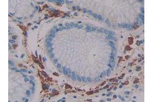 Immunohistochemistry (IHC) image for anti-Linker For Activation of T Cells Family, Member 2 (LAT2) (AA 30-209) antibody (ABIN7439774)