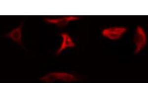 ABIN6274783 staining Hela cells by IF/ICC. (RPL5 antibody  (C-Term))