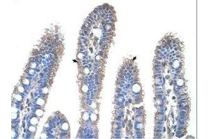 Image no. 1 for anti-Ornithine Carbamoyltransferase (OTC) (N-Term) antibody (ABIN203390) (OTC antibody  (N-Term))