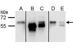 IP Image Sample (ug of whole cell lysate) A: 293 (input) B: control rabbit IgG-IP C: Stau1-IP , D: Post-IP lysate from control rabbit IgG-IP E:Post-IP lysate from Stau1-IP 7. (STAU1/Staufen antibody  (C-Term))