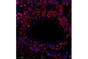 Immunofluorescent analysis of paraffin embedded rat testis using RPL10L (ABIN7075429) at dilution of 1: 650
