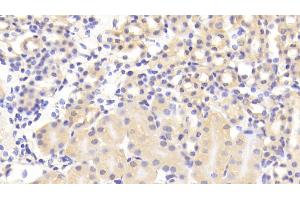 Detection of CAMLG in Mouse Kidney Tissue using Polyclonal Antibody to Calcium Modulating Ligand (CAMLG) (CAMLG antibody  (AA 1-187))