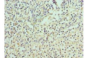 Immunohistochemistry of paraffin-embedded human spleen tissue using ABIN7166400 at dilution of 1:100 (PAD4 antibody  (AA 1-250))