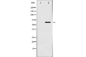 Western blot analysis of p62 Dok expression in K562 whole cell lysates,The lane on the left is treated with the antigen-specific peptide. (DOK1 antibody  (Internal Region))