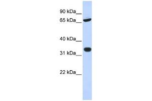 WB Suggested Anti-TRIM28 Antibody Titration:  0. (KAP1 antibody  (N-Term))