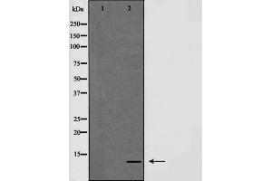 Western blot analysis of NDUFA4 expression in HepG2 cells,The lane on the left is treated with the antigen-specific peptide. (NDUFA4 antibody  (C-Term))