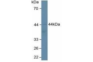 Detection of ADIPOR2 in Human Hela Cells using Polyclonal Antibody to Adiponectin Receptor 2 (ADIPOR2) (Adiponectin Receptor 2 antibody  (AA 2-155))