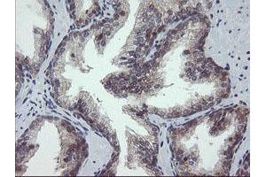 Image no. 1 for anti-Golgin, RAB6-Interacting (GORAB) (AA 35-394) antibody (ABIN1491441) (GORAB antibody  (AA 35-394))