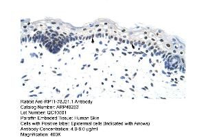 Rabbit Anti-RP11-78J21. (HNRNPA1L2 antibody  (N-Term))