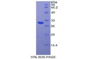 SDS-PAGE analysis of Human Myosin IA Protein. (Myosin IA Protein (MYO1A))