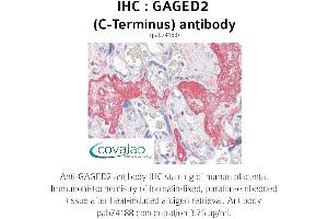 Image no. 1 for anti-X Antigen Family, Member 1B (XAGE1B) (C-Term) antibody (ABIN1734558)