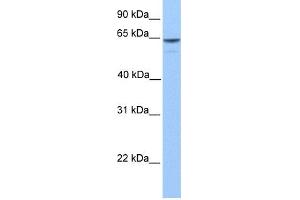 WB Suggested Anti-KIAA1958 Antibody Titration: 0. (KIAA1958 antibody  (C-Term))